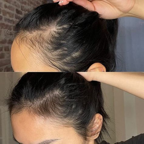 Grow Baby Grow – Advanced Hair Growth Vitalizer